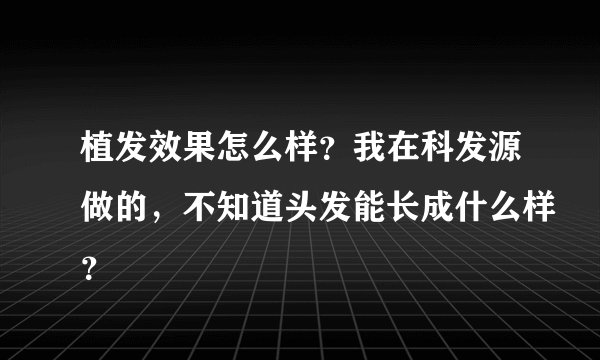 植发效果怎么样？我在科发源做的，不知道头发能长成什么样？