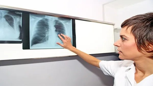 癌症有什么症状
