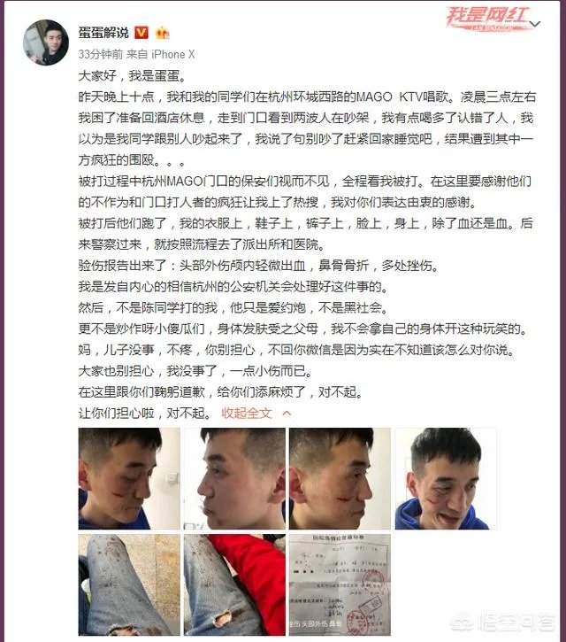 贝拉拉是谁,最近为什么这么火?听说他在工体被打了?
