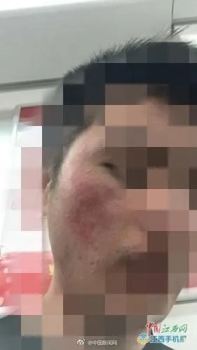 网曝南昌天虹使用伪劣化妆品致多名大学生毁容,是怎么一回事?