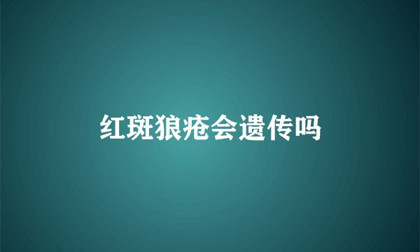 红斑狼疮会遗传吗