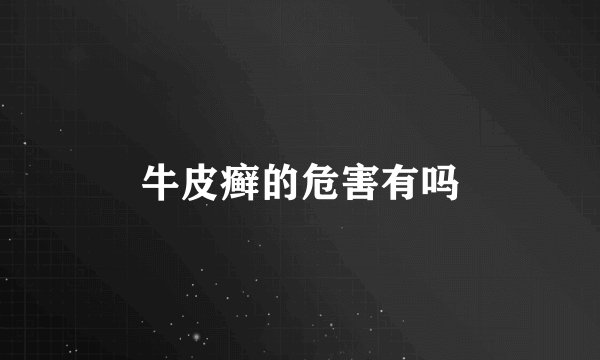 牛皮癣的危害有吗
