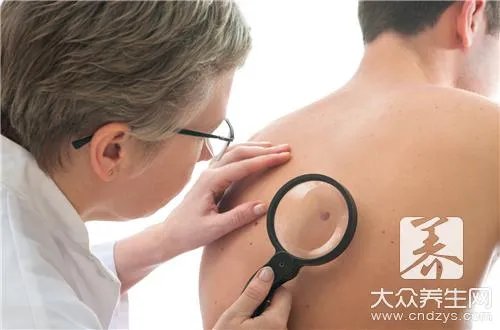  手术去痣后的三个月图