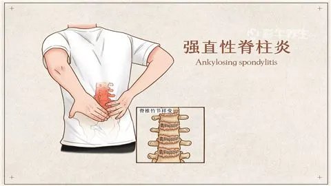 后背疼痛是什么原因有哪些