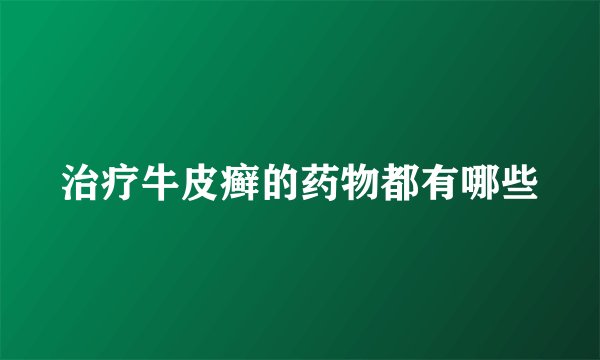 治疗牛皮癣的药物都有哪些