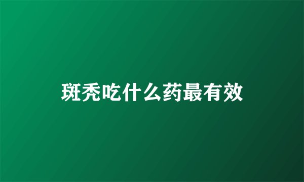 斑秃吃什么药最有效