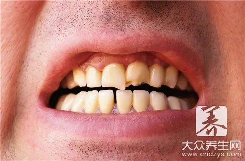 黑牙会遗传