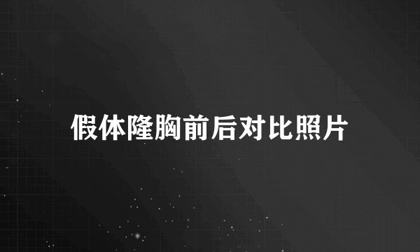 假体隆胸前后对比照片