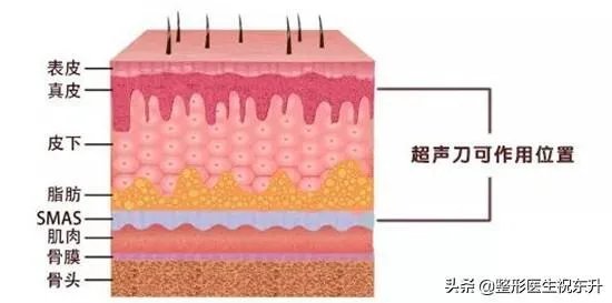 超声刀危害有哪些?