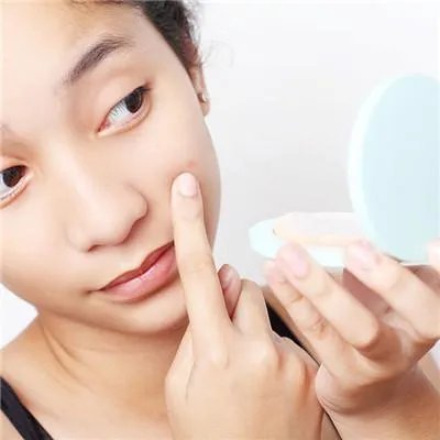 哪个治青春痘医院比较好??