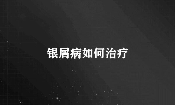 银屑病如何治疗