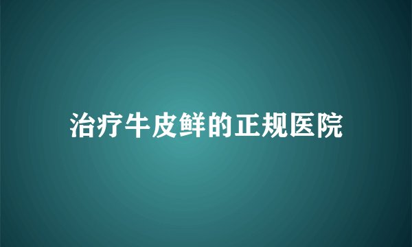 治疗牛皮鲜的正规医院