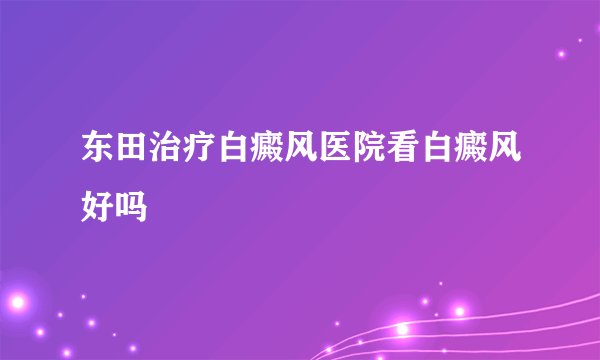 东田治疗白癜风医院看白癜风好吗