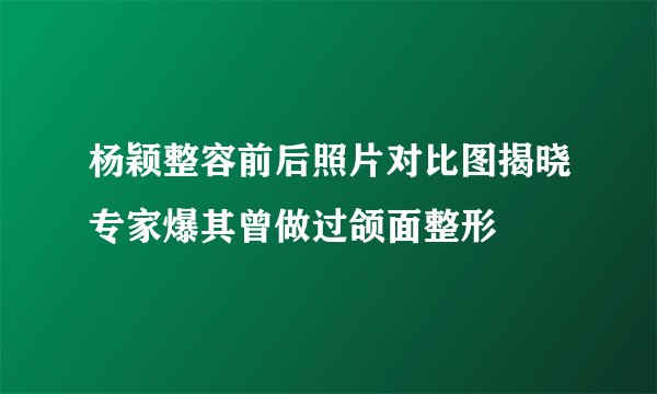 杨颖整容前后照片对比图揭晓专家爆其曾做过颌面整形