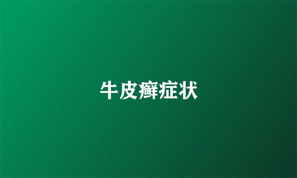 牛皮癣症状