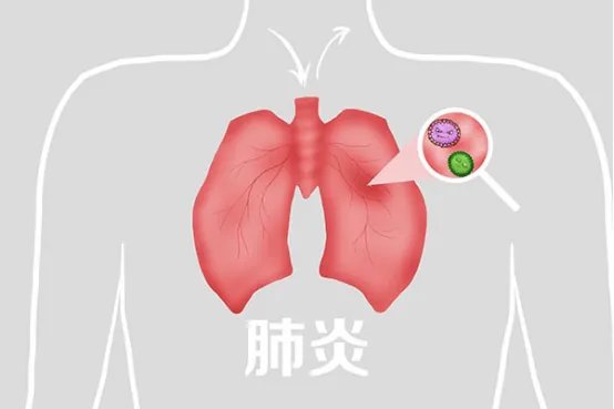 天门冬氨酸氨基转移酶偏高的原因有哪些