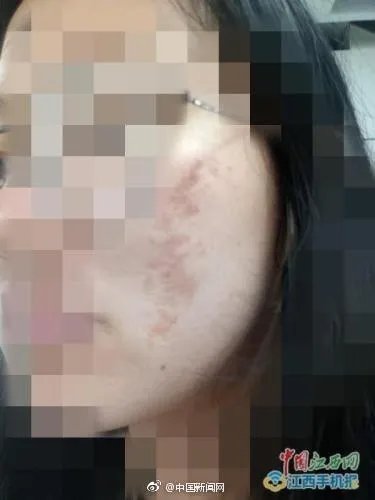 网曝南昌天虹使用伪劣化妆品致多名大学生毁容,是怎么一回事?