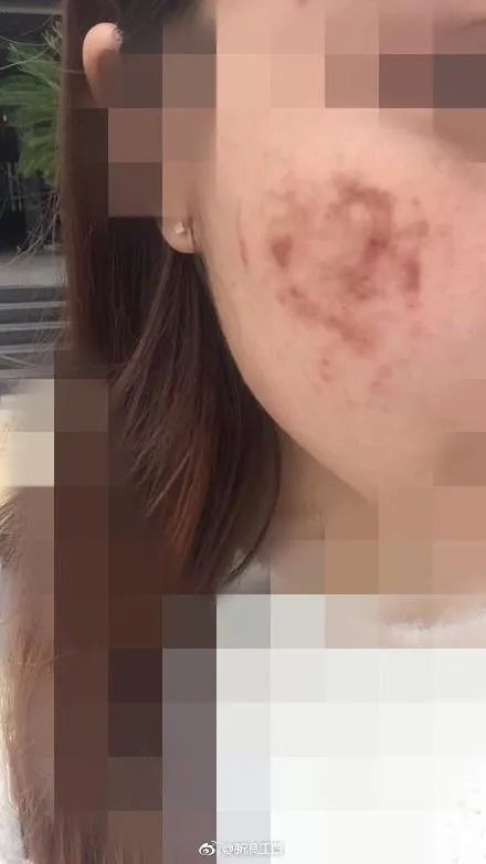 网曝南昌天虹使用伪劣化妆品致多名大学生毁容,是怎么一回事?