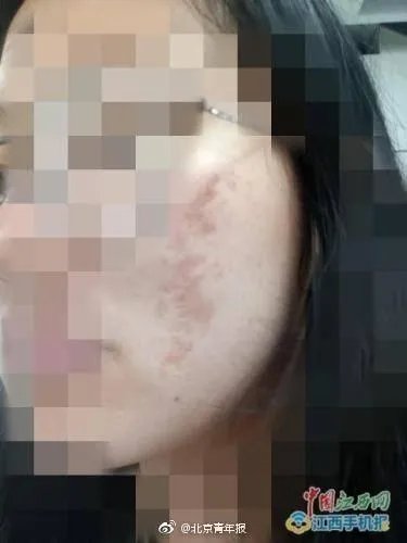 网曝南昌天虹使用伪劣化妆品致多名大学生毁容,是怎么一回事?