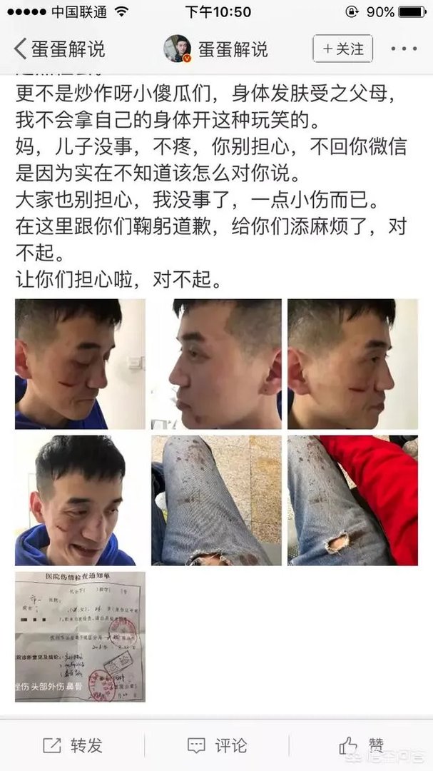 贝拉拉是谁,最近为什么这么火?听说他在工体被打了?