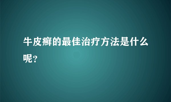 牛皮癣的最佳治疗方法是什么呢？