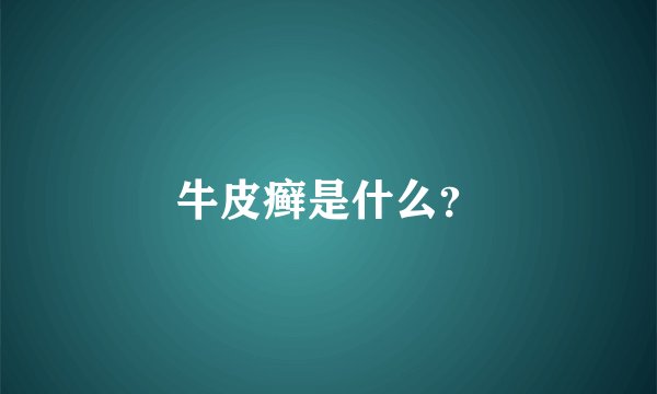 牛皮癣是什么？