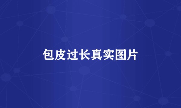 包皮过长真实图片