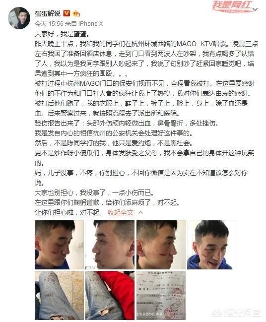 贝拉拉是谁,最近为什么这么火?听说他在工体被打了?