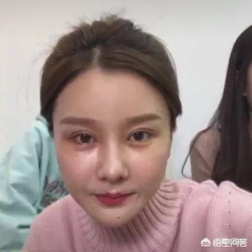 割双眼皮到底该不该开不开眼角？
