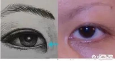 割双眼皮到底该不该开不开眼角?