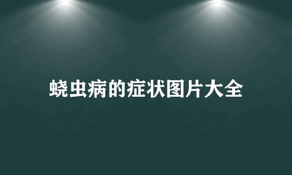 蛲虫病的症状图片大全