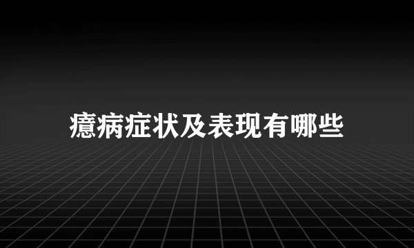 癔病症状及表现有哪些