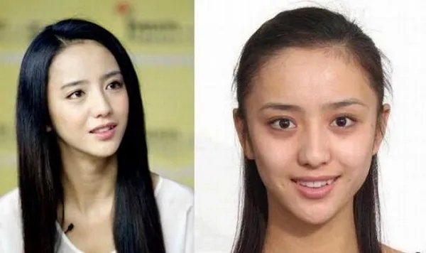佟丽娅整容前后大对比 整容前17岁照片差别大