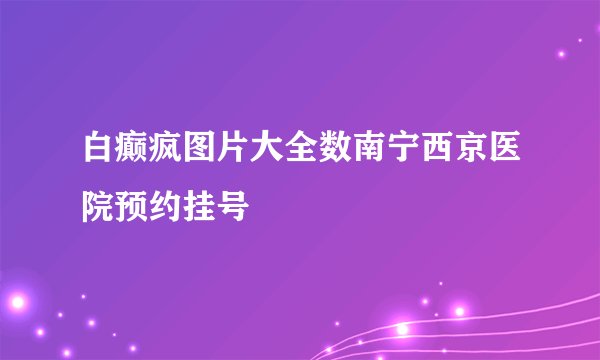 白癫疯图片大全数南宁西京医院预约挂号