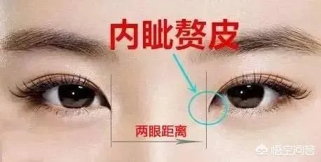 割双眼皮到底该不该开不开眼角?
