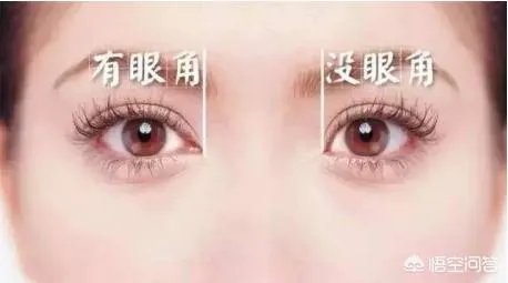 割双眼皮到底该不该开不开眼角?