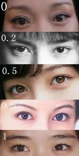 割双眼皮到底该不该开不开眼角?