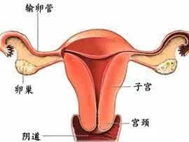 子宫癌是怎样的?