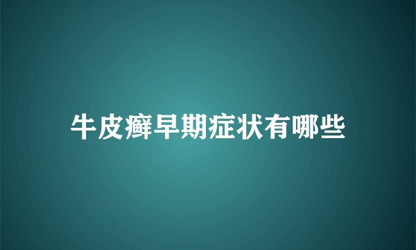 牛皮癣早期症状有哪些