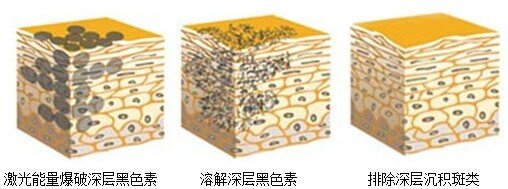 祛斑最有效的方法
