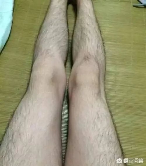 怎样简单除腋毛?