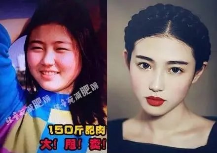 张辛苑减肥前后照片对比，曾经也是一个150斤的小胖妞