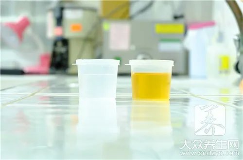  尿滞留和尿潴留区别