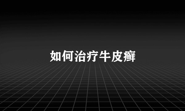 如何治疗牛皮癣
