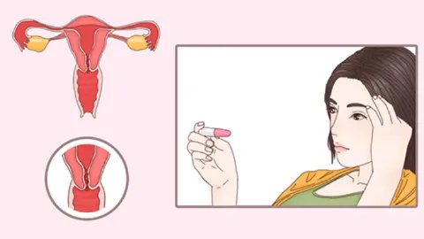宫颈细胞学检查是什么