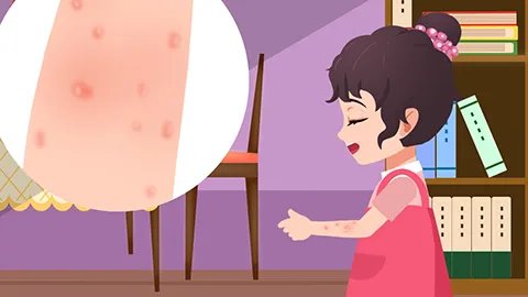 寒冷性荨麻疹的治疗方法