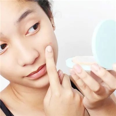 如何去除青春痘