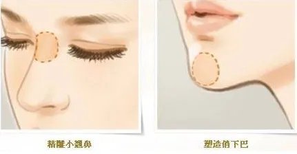 玻尿酸价格是多少钱呢