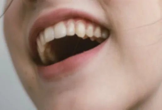 梦见掉了两颗牙是什么意思 梦见掉了两颗牙有什么征兆