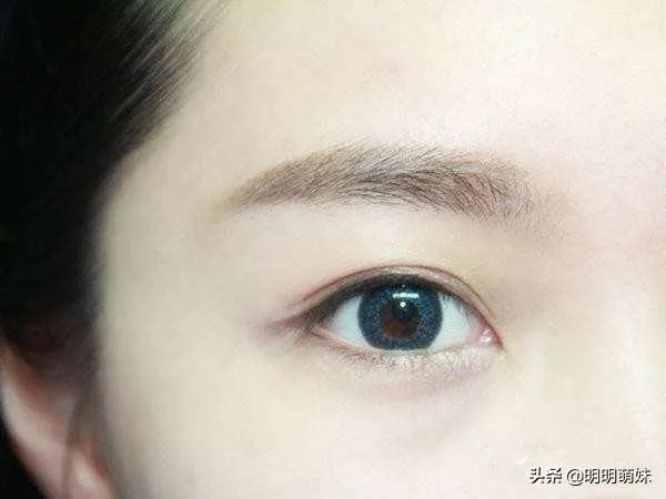 割双眼皮到底该不该开不开眼角?